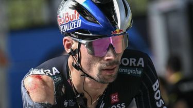 Red Bull - BORA - hansgrohe team's Slovenian rider Primoz Roglic, with visible injuries sustained in a crash in the final kilometers of the stage, cycles past the finish line of the 12th stage of the 111th edition of the Tour de France cycling race, 203,6 km between Aurillac and Villeneuve-sur-Lot, southwestern France, on July 11, 2024. 
Marco BERTORELLO / AFP